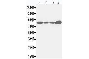 Anti-Integrin beta 3 antibody, Western blotting Lane 1: JURKAT Cell Lysate Lane 2: RAJI Cell Lysate Lane 3: CEM Cell Lysate Lane 4: COLO320 Cell Lysate (Integrin beta 3 anticorps  (C-Term))