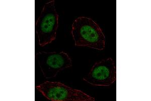 Fluorescent image of  cell stained with MSX1 Antibody (Center) (ABIN1537757 and ABIN2838265). (MSX1 anticorps  (AA 111-138))