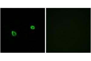 Immunofluorescence analysis of A549 cells, using ERN2 Antibody. (ERN2 anticorps  (AA 841-890))