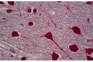 Anti-FOS / c-FOS antibody IHC staining of human brain, cortex. (c-FOS anticorps)