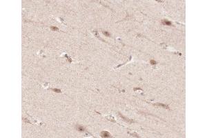 ABIN6266663 at 1/100 staining human brain tissue sections by IHC-P. (TNFRSF1A anticorps  (C-Term))