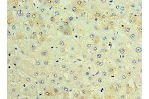 Immunohistochemistry of paraffin-embedded human liver tissue using ABIN7171674 at dilution of 1:100 (TCTN2 anticorps  (AA 420-670))