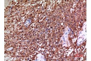 Immunohistochemistry (IHC) analysis of paraffin-embedded Human Brain, antibody was diluted at 1:100. (alpha Tubulin anticorps)