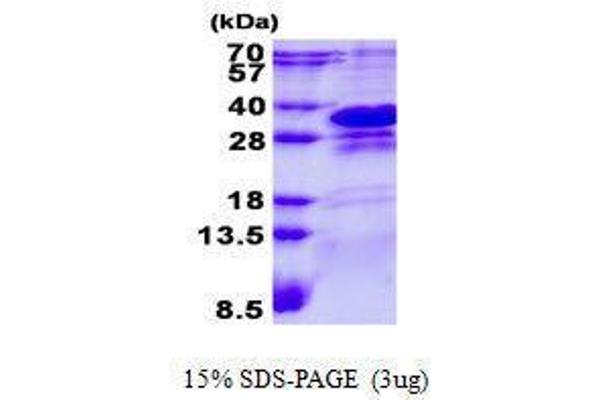 CHMP1A Protéine