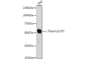 Western blot analysis of extracts of Raji cells, using L-Plastin/LCP1 antibody (ABIN7268317) at 1:1000 dilution. (LCP1 anticorps)