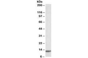 Western blot testing of human duodenum lysate with B2M antibody at 0. (beta-2 Microglobulin anticorps)