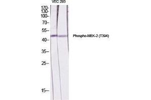 Western Blot (WB) analysis of specific cells using Phospho-MEK-2 (T394) Polyclonal Antibody. (MEK2 anticorps  (pThr394))