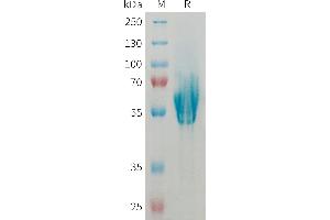 MADCAM1 Protein (AA 19-317) (His tag)