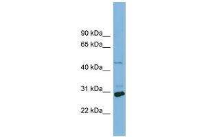 WB Suggested Anti-SLC16A1  Antibody Titration: 0. (SLC16A1 anticorps  (Middle Region))
