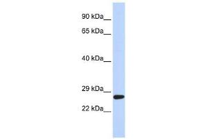 SETD4 antibody used at 0. (SETD4 anticorps  (C-Term))