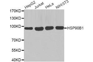 Western blot analysis of extracts of various cell lines, using HSP90B1 antibody (ABIN2968872). (GRP94 anticorps)