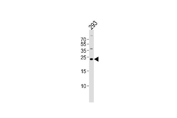 GADD45GIP1 anticorps  (N-Term)