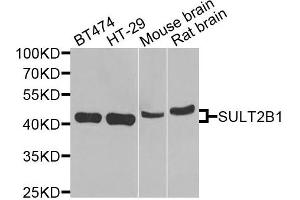 Western blot analysis of extracts of various cells, using SULT2B1 antibody. (SULT2B1 anticorps)