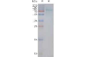 Human R-Nanodisc, Flag Tag on SDS-PAGE (UTS2R Protéine)
