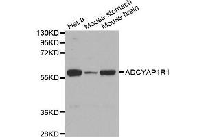 Western Blotting (WB) image for anti-Adenylate Cyclase Activating Polypeptide 1 (Pituitary) Receptor Type I (ADCYAP1R1) antibody (ABIN6220077) (ADCYAP1R1 anticorps)