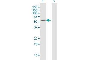 Western Blot analysis of HNF4A expression in transfected 293T cell line by HNF4A MaxPab polyclonal antibody. (HNF4A anticorps  (AA 1-464))