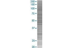 AGTRAP transfected lysate. (AGTRAP 293T Cell Transient Overexpression Lysate(Denatured))