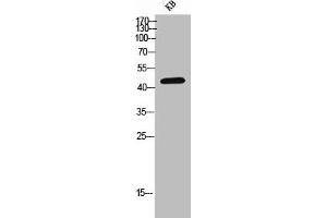 Western Blot analysis of KB cells using CD155 Polyclonal Antibody (Poliovirus Receptor anticorps  (Internal Region))