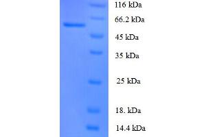 SDS-PAGE (SDS) image for Angiopoietin 1 (ANGPT1) (AA 16-498) protein (His tag) (ABIN5711317) (Angiopoietin 1 Protein (ANGPT1) (AA 16-498) (His tag))