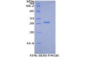 SDS-PAGE (SDS) image for Axin 1 (AXIN1) (AA 618-827) protein (His tag) (ABIN2124105) (Axin Protein (AA 618-827) (His tag))