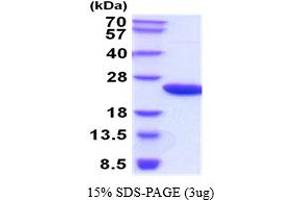 SDS-PAGE (SDS) image for Retinol Binding Protein 4, Plasma (RBP4) (AA 19-201) protein (His tag) (ABIN6387731) (RBP4 Protein (AA 19-201) (His tag))