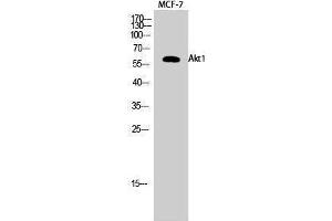 Western Blotting (WB) image for anti-V-Akt Murine Thymoma Viral Oncogene Homolog 1 (AKT1) (Ser137) antibody (ABIN6284493) (AKT1 anticorps  (Ser137))