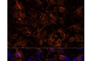 Immunofluorescence analysis of C6 cells using NCAM1 / CD56 Polyclonal Antibody at dilution of 1:100. (CD56 anticorps)