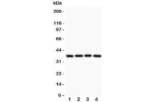 Western blot testing of MCL1 antibody and Lane 1:  rat spleen;  2: human HEPG2;  3: (h) MCF-7;  4: (h) COLO320 (MCL-1 anticorps  (AA 1-350))