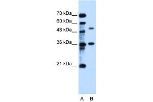 C9ORF127 antibody used at 2. (TMEM8B anticorps  (C-Term))