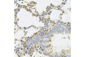 Immunohistochemistry of paraffin-embedded rat lung using UBE2B Antibody. (UBE2B anticorps)