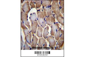 SEPN1 Antibody immunohistochemistry analysis in formalin fixed and paraffin embedded human skeletal muscle followed by peroxidase conjugation of the secondary antibody and DAB staining. (SEPN1 anticorps  (C-Term))