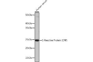 Western blot analysis of extracts of Human serum, using C-Reactive Protein (C-Reactive Protein (CRP)) antibody (ABIN7265972) at 1:1000 dilution. (CRP anticorps)