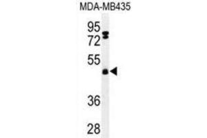 Western Blotting (WB) image for anti-F-Box and Leucine-Rich Repeat Protein 2 (FBXL2) antibody (ABIN3002209) (FBXL2 anticorps)