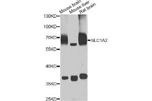 Western blot analysis of extracts of various cell lines, using SLC1A2 antibody (ABIN5995519) at 1/1000 dilution. (SLC1A2 anticorps)