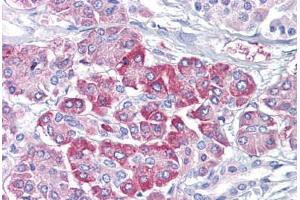 Anti-NRAS antibody IHC staining of human pancreas. (GTPase NRas anticorps)