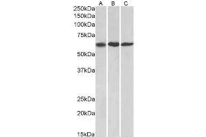 Western Blotting (WB) image for anti-Matrix Metallopeptidase 14 (Membrane-inserted) (MMP14) antibody (ABIN5928778) (MMP14 anticorps)