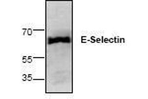Image no. 1 for anti-Selectin E (SELE) antibody (ABIN127258) (Selectin E/CD62e anticorps)