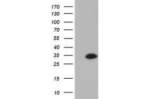 HEK293T cells were transfected with the pCMV6-ENTRY control (Left lane) or pCMV6-ENTRY KHK (Right lane) cDNA for 48 hrs and lysed. (Ketohexokinase anticorps)