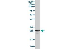 CAV1 MaxPab rabbit polyclonal antibody. (Caveolin-1 anticorps  (AA 1-178))