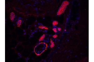 human sole sweat gland (courtesy of L. (KRT17 anticorps)