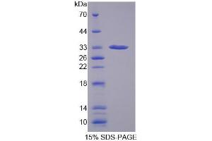 SDS-PAGE analysis of Human GBP1 Protein. (GBP1 Protéine)