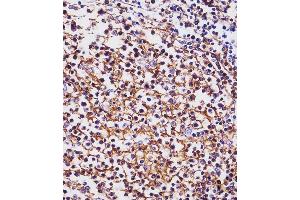 (ABIN1536600 and ABIN2843823) staining MS4A1/CD20 in human tonsil tissue sections by Immunohistochemistry (IHC-P - paraformaldehyde-fixed, paraffin-embedded sections). (CD20 anticorps  (C-Term))