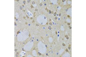Immunohistochemistry of paraffin-embedded mouse brain using YWHAZ antibody. (14-3-3 zeta anticorps)