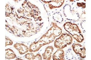 Immunohistochemistry (Paraffin-embedded Sections) (IHC (p)) image for anti-Aquaporin 1 (Colton Blood Group) (AQP1) (AA 181-269) antibody (ABIN687502)