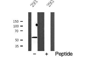 Western blot analysis of ACV1B expression in 293 cells (Activin A Receptor Type IB/ALK-4 anticorps  (Internal Region))