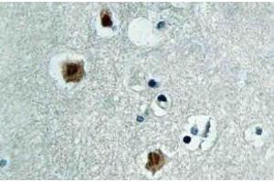 Immunohistochemistry (IHC) analyzes of PAKbeta antibody in paraffin-embedded human brain tissue. (PAK3 anticorps)