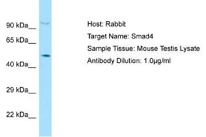Host: Rabbit Target Name: SMAD4 Sample Tissue: Mouse Testis Antibody Dilution: 1ug/ml (SMAD4 anticorps  (C-Term))
