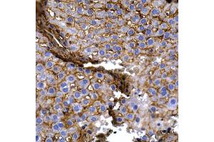 Immunohistochemistry (IHC) image for anti-Caspase 8 (CASP8) (AA 1-479) antibody (ABIN6137970)