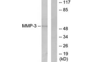 Western Blotting (WB) image for anti-Matrix Metallopeptidase 3 (Stromelysin 1, Progelatinase) (MMP3) (AA 421-470) antibody (ABIN2889233) (MMP3 anticorps  (AA 421-470))