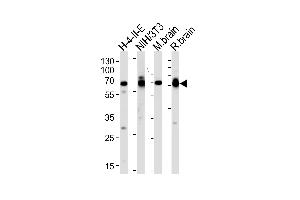 Western blot analysis of lysates from H-4-II-E, mouse NIH/3T3 cell line, mouse brain and rat brain tissues (from left to right), using STIP1 Antibody at 1:1000 at each lane. (STIP1 anticorps  (C-Term))